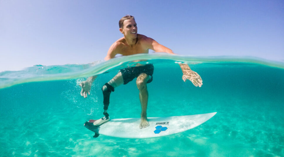 He Survived a Shark Attack. Here's Why He Wants to Protect Them.